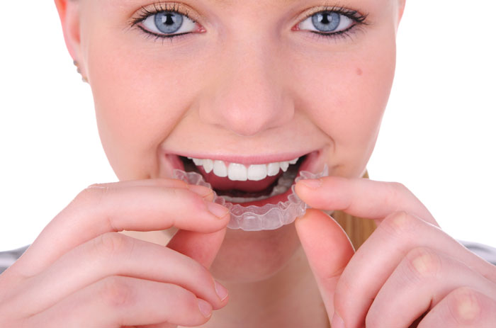 How Does Invisalign Move My Teeth?