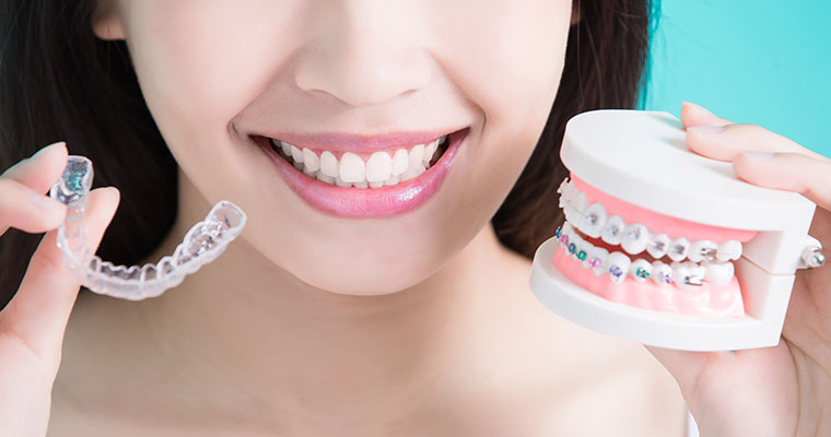 Female smiling and holding a clear aligner tray and a cast of teeth with metal braces