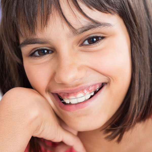 What Is the Best Orthodontic Retainer?